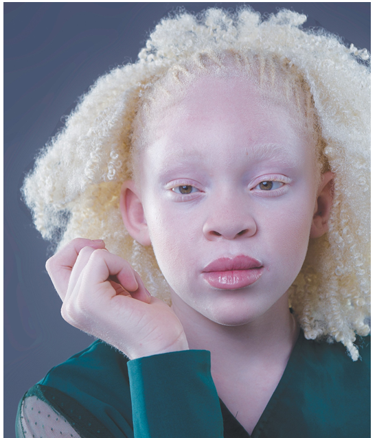 Thabo Kamba: Shining star in fight against discrimination